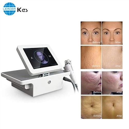Rf Microneedle Rf Microneedling Machine Салон Использование портативного фракционного RF лифтинга лица Microneedle Equipo